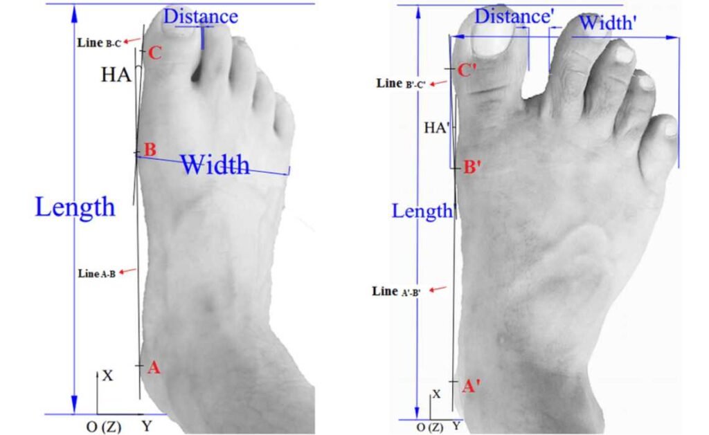 Anatomy of the foot